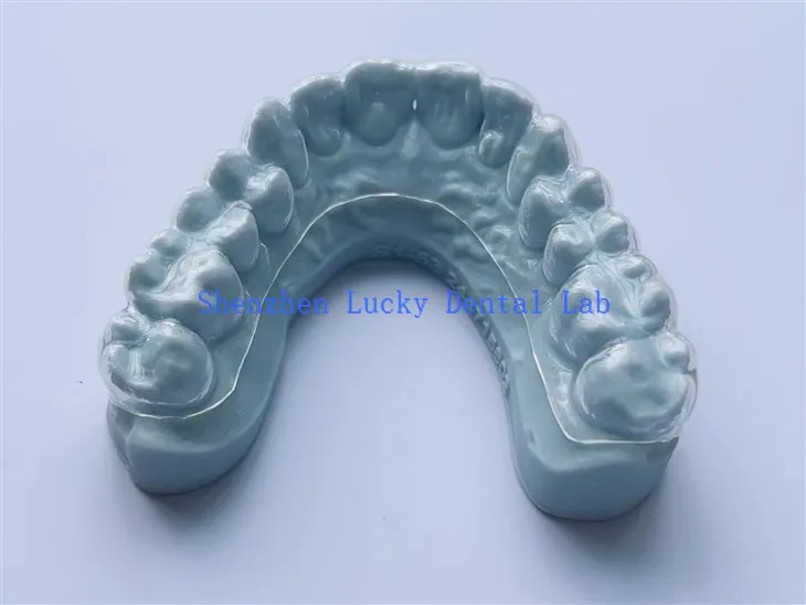 3D -s nyomtatott fehérítő tálca fogászati ​​laboratórium