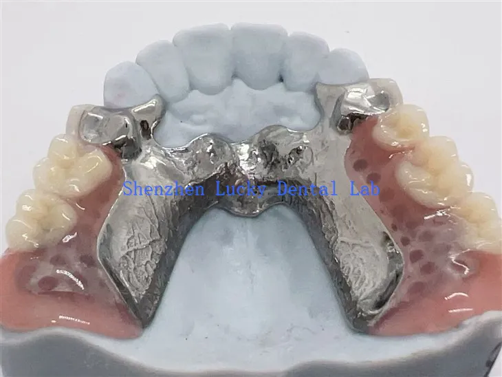 3D nyomtatási titánötvözet váz