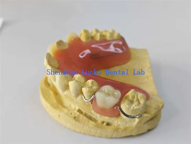 Kényelmes huzalhajlítási kanyar kapcsás akril fogsor fogászati ​​laboratórium