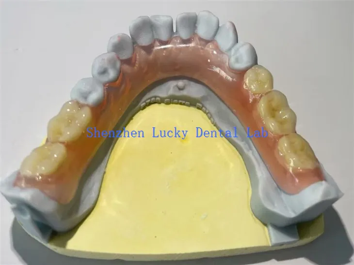 Kényelmes részleges rugalmas fogászati ​​fogsor gyártók