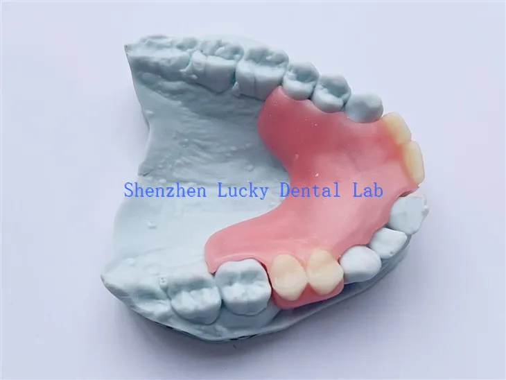 Testreszabott fogászati ​​részleges rugalmas fogsor próbálkozás a gyártókban