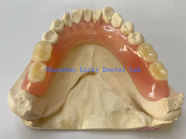 Particiális rugalmas fogsor fogsor laboratórium