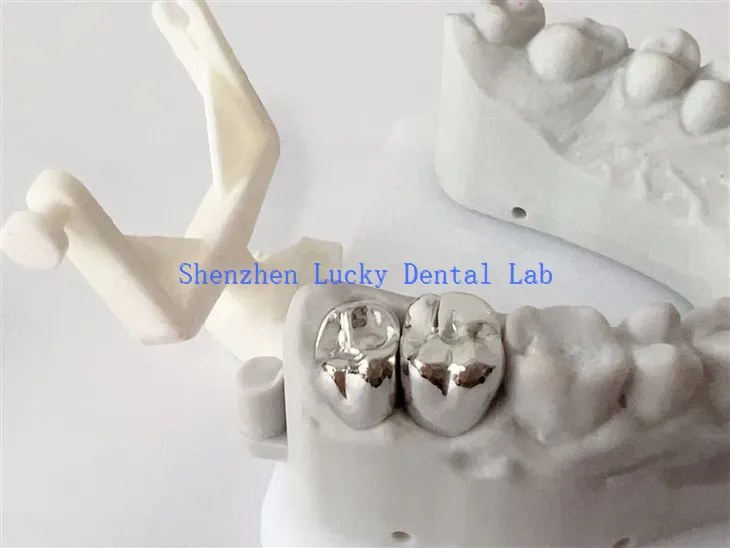 Dental COCR Full Metal Crown Dental Lab