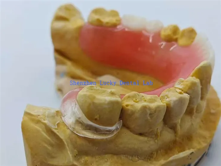 Akril fogsor tiszta kapocsgal