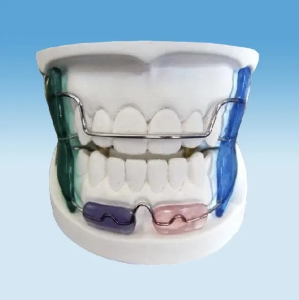 Frankel ortodontika a gyerek számára