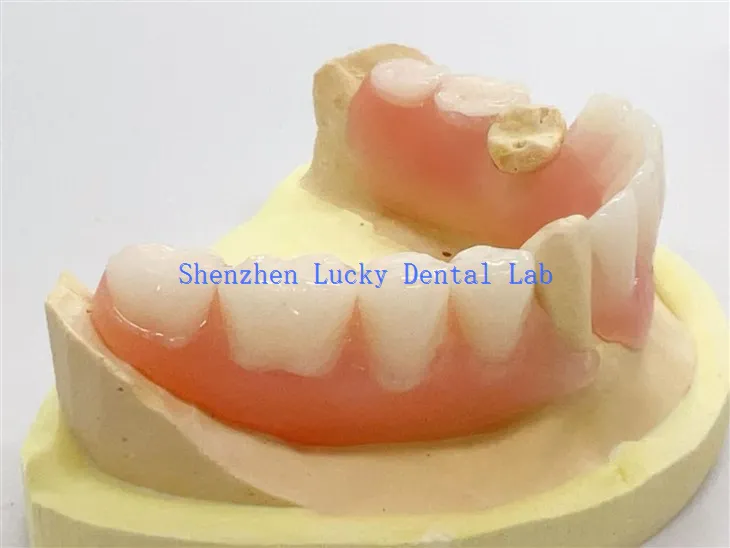 Kiváló minőségű fogászati részleges rugalmas fogsor