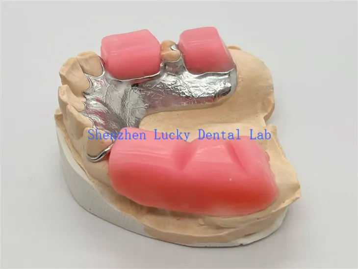 Fém Keret Bite Block-al