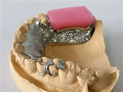 Fémkeret viasz peremmel és nyelvi tányér fogászati ​​laboratóriummal