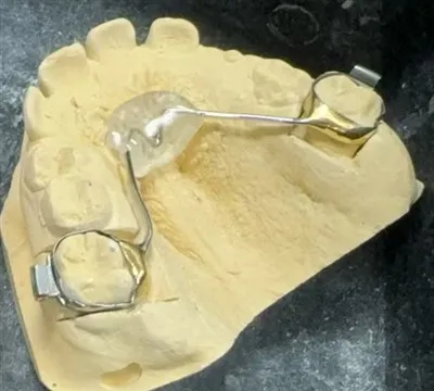 Kínai Nance Retainer Factory