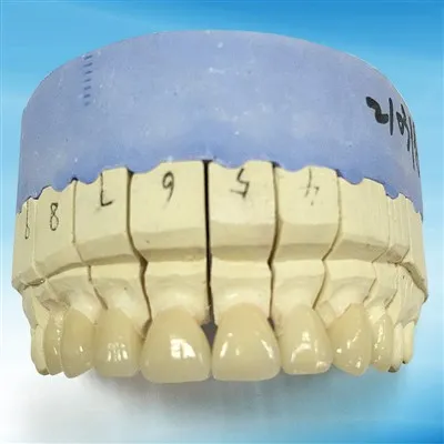 Kiváló Dental PFM Ni Cr Crowns Bridge