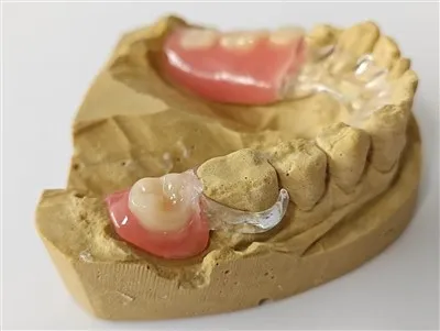 Kiváló minőségű, tiszta fémkeretű, tiszta kapocskínával, Kínában